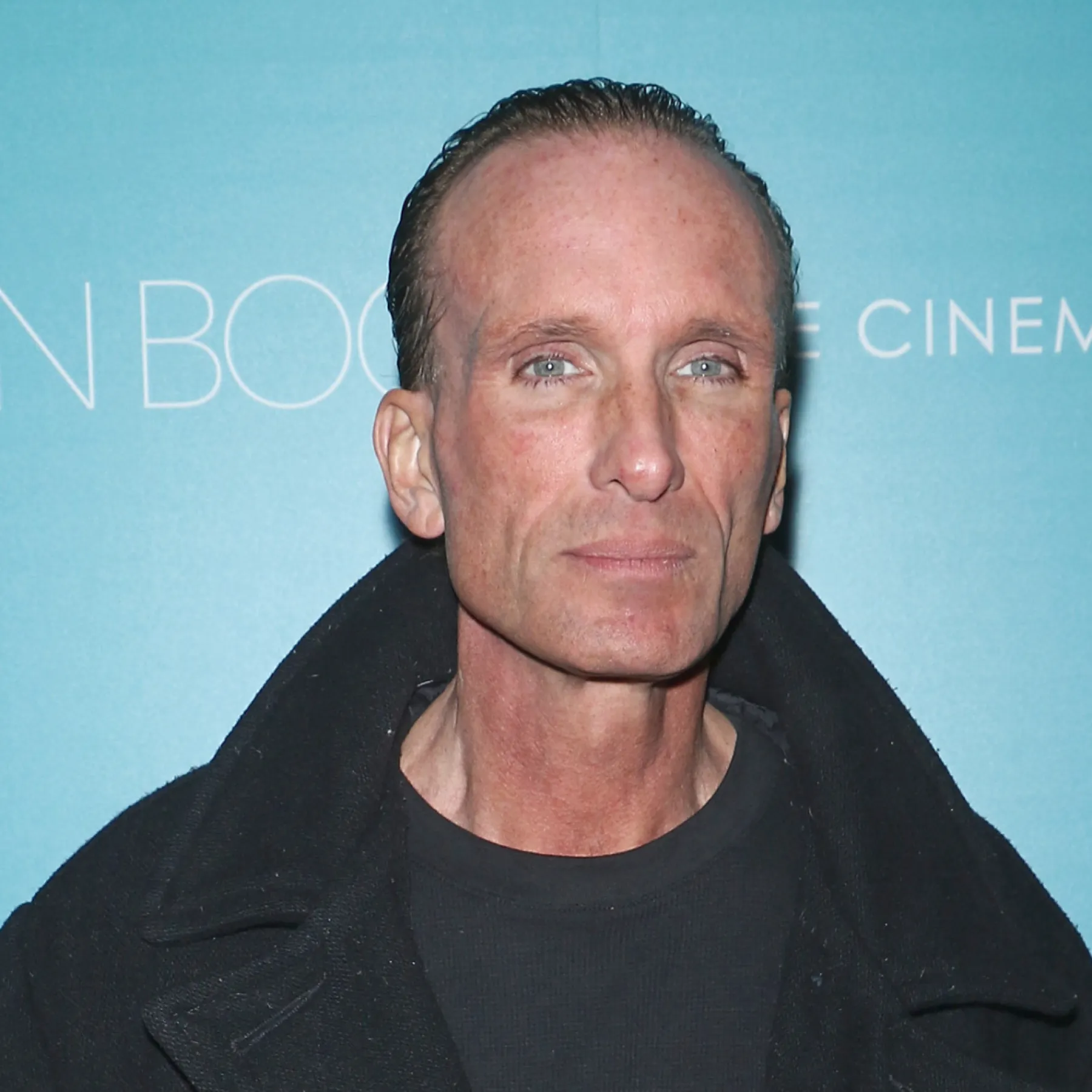 Peter Greene Died From Accidental Shooting, Medical Examiner Says